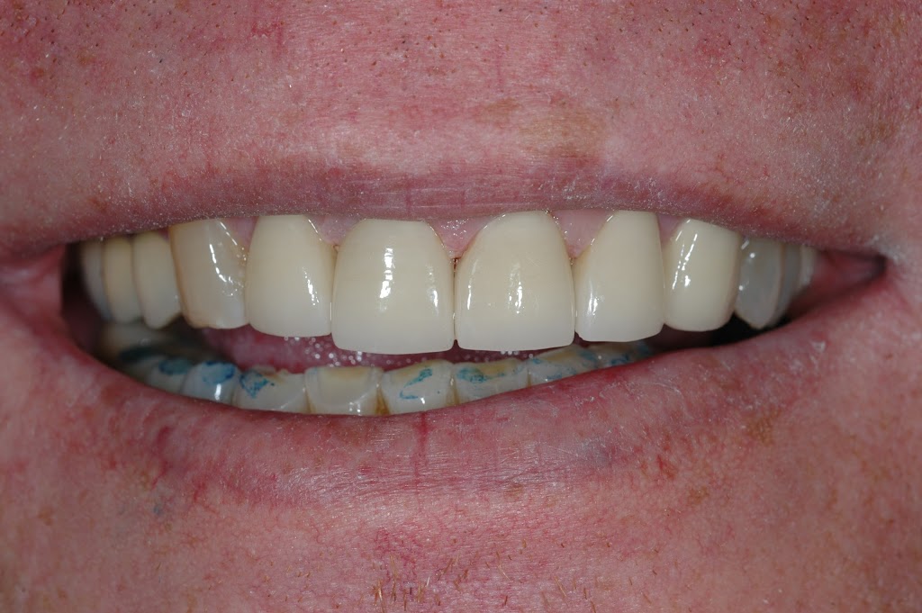 Rizvi Dental - Zonies-Holgado Dental Associates | 401 Kings Hwy S STE 2A, Cherry Hill, NJ 08034 | Phone: (856) 429-4600