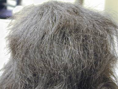 Hudson Valley Hair Loss | 10A Western Ave, Marlboro, NY 12542 | Phone: (845) 219-5400
