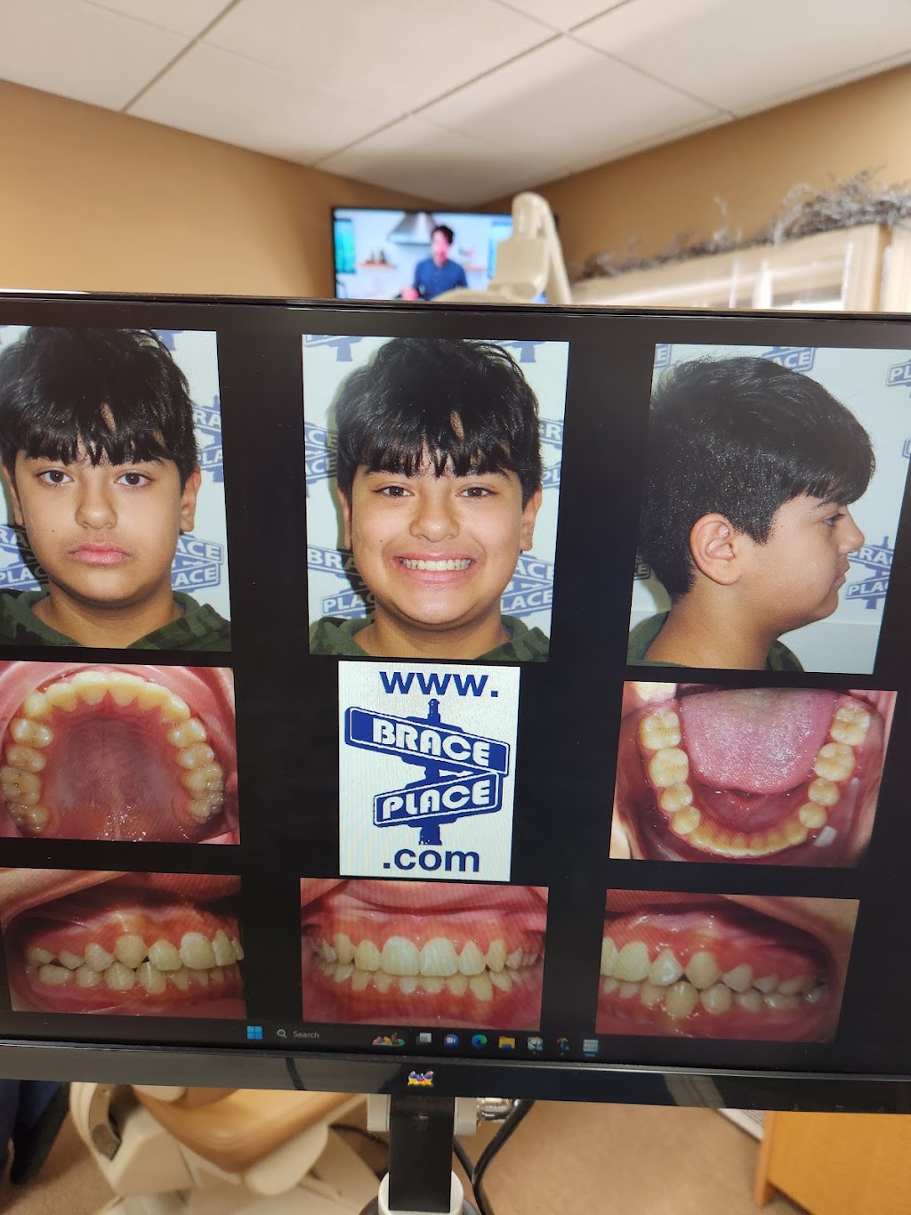 Brace Place Orthodontics | 800 Tennent Rd, Manalapan Township, NJ 07726 | Phone: (732) 536-4422