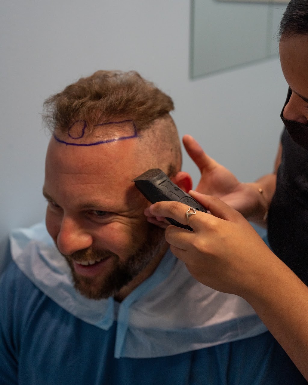 FUE Hair Transplant Solution New Jersey | 4057 Asbury Ave Suite 021, Tinton Falls, NJ 07753 | Phone: (848) 420-9970
