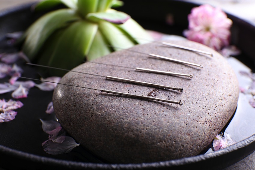 Eastern Wellness Acupuncture | 83 Montgomery Ave, Scarsdale, NY 10583 | Phone: (914) 472-6688