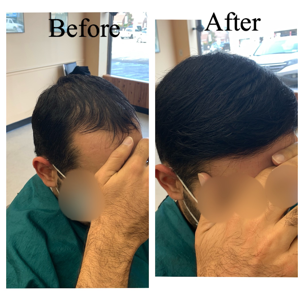 Ultimate Mens Hair Replacement | 2548 Merrick Rd, Bellmore, NY 11710 | Phone: (917) 435-8244