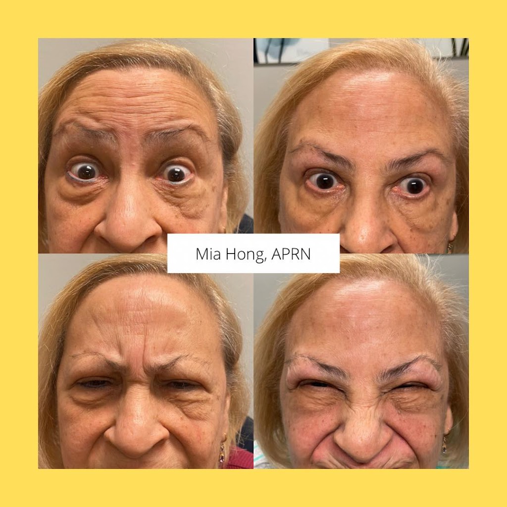 About Face MD | 10 Higgins Hwy, Mansfield Center, CT 06250 | Phone: (860) 634-9646