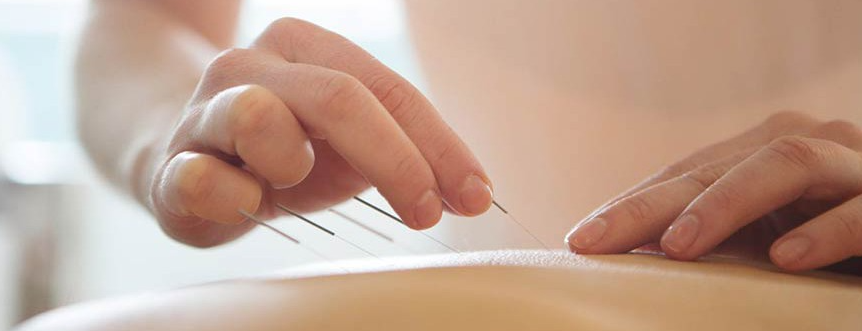 Medical Acupuncture of Chester County | 1217 West Chester Pike, West Chester, PA 19382 | Phone: (610) 431-0850