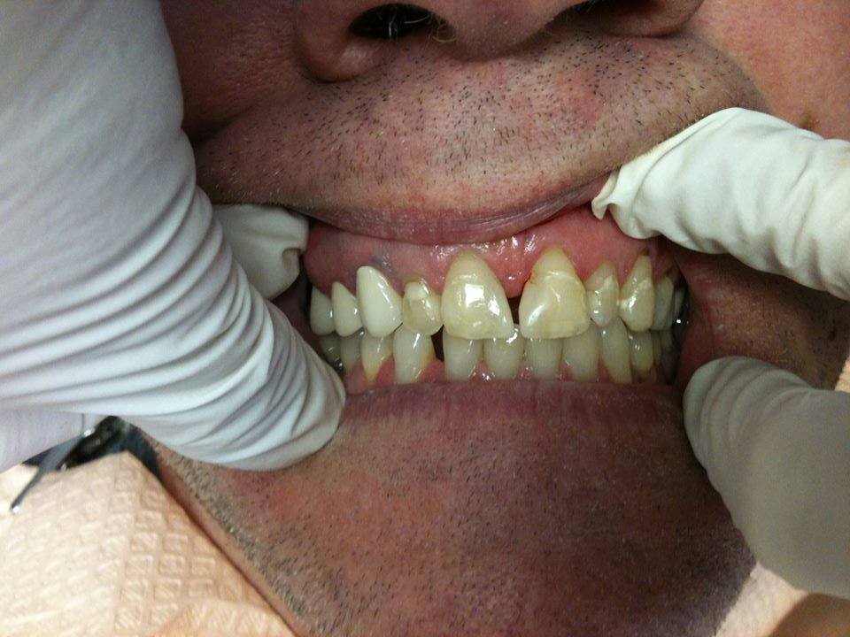Nice Care Dental | 1320 W Ritner St, Philadelphia, PA 19148 | Phone: (215) 389-3876