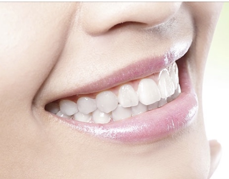 Dental Cosmetic Center of Piscataway | 1100 Centennial Ave Suite 101, Piscataway, NJ 08854 | Phone: (732) 562-1111