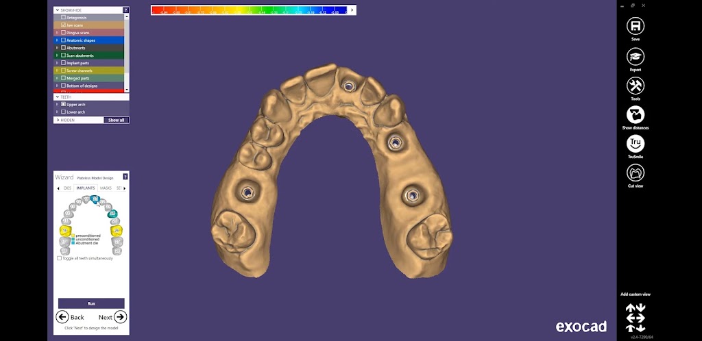 Choisdental Tec | 25 Aladdin Ave suite#2, Dumont, NJ 07628 | Phone: (201) 244-6966