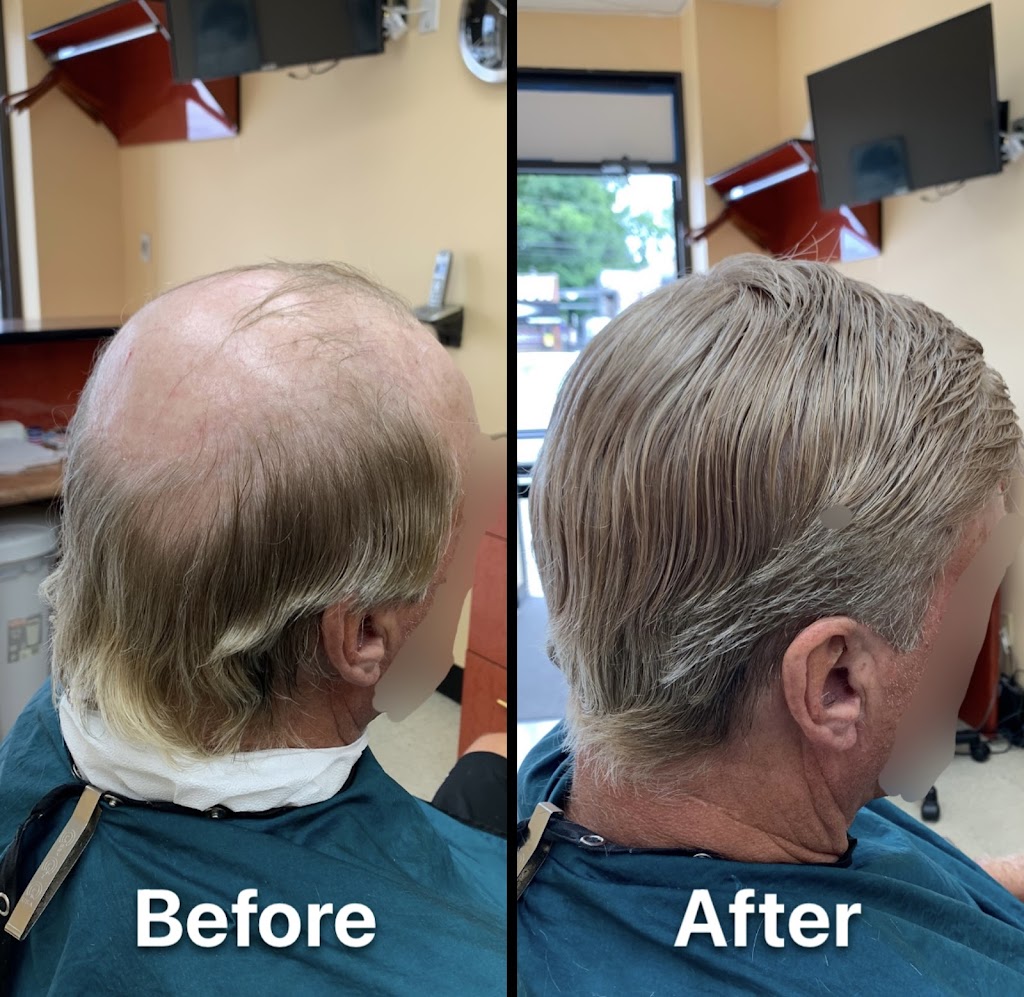 Ultimate Mens Hair Replacement | 2548 Merrick Rd, Bellmore, NY 11710 | Phone: (917) 435-8244
