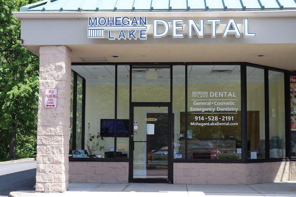 Mohegan Lake Dental PC | 1719 E Main St, Mohegan Lake, NY 10547 | Phone: (914) 528-2191
