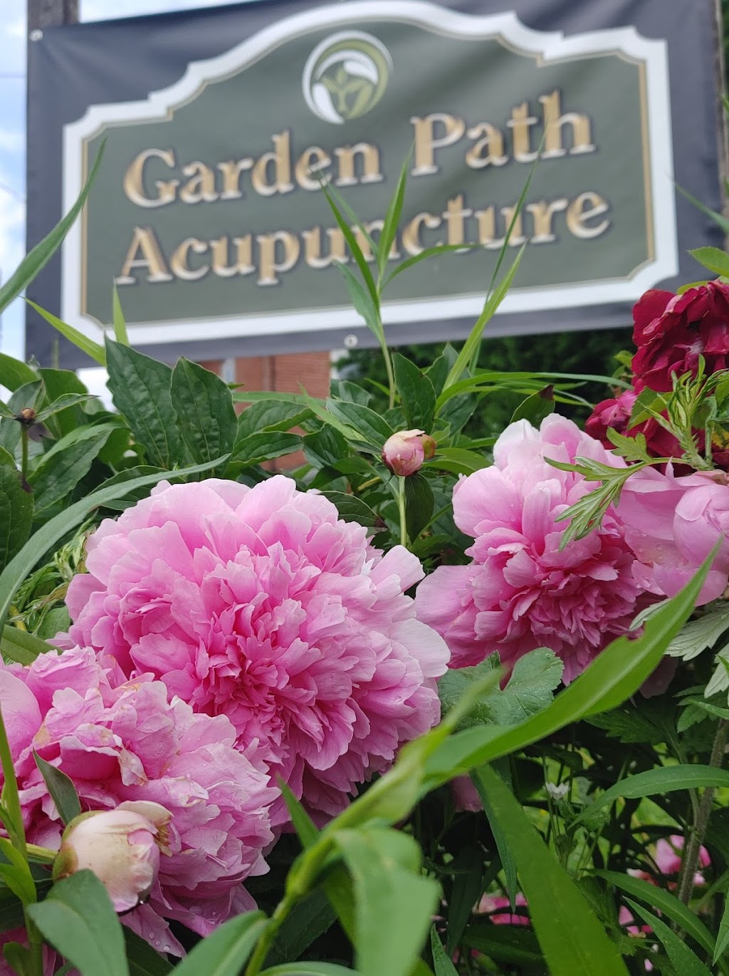 Garden Path Acupuncture | 17 N 2nd St, Souderton, PA 18964 | Phone: (267) 875-3797