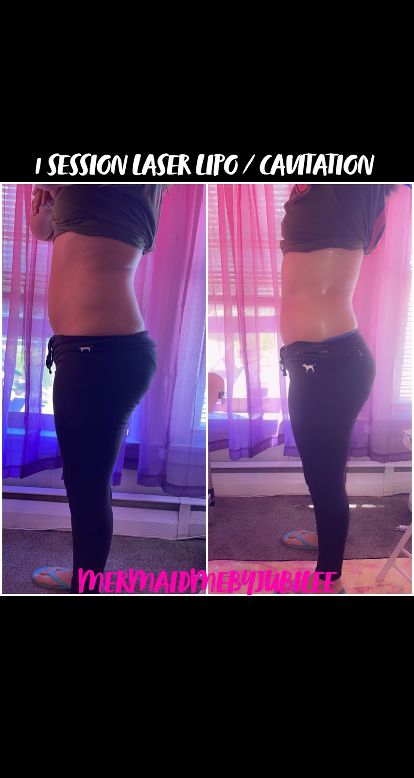 Mermaid Me Body Sculpting | 16 Franklindale Ave, Wappingers Falls, NY 12590 | Phone: (315) 246-8339