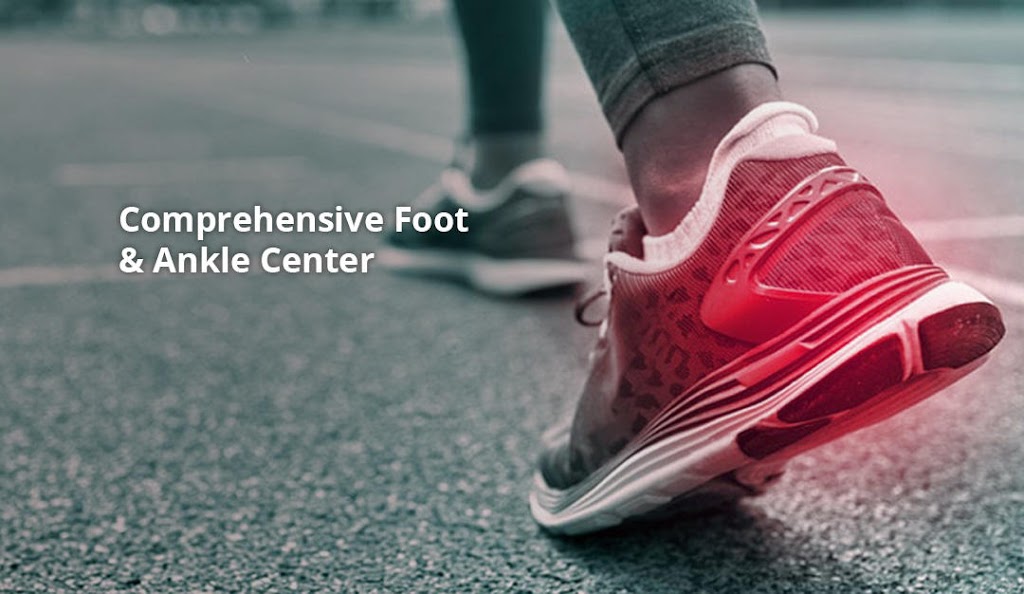 Comprehensive Foot & Ankle Center | 555 2nd Ave c750, Collegeville, PA 19426 | Phone: (610) 409-0800
