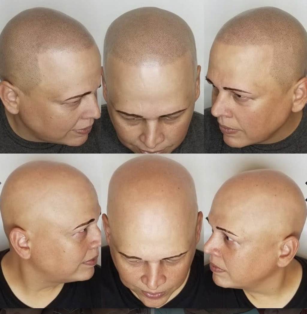 H.A.I.R. Scalp Micropigmentation | 59 Main St, Walden, NY 12586 | Phone: (845) 401-3082