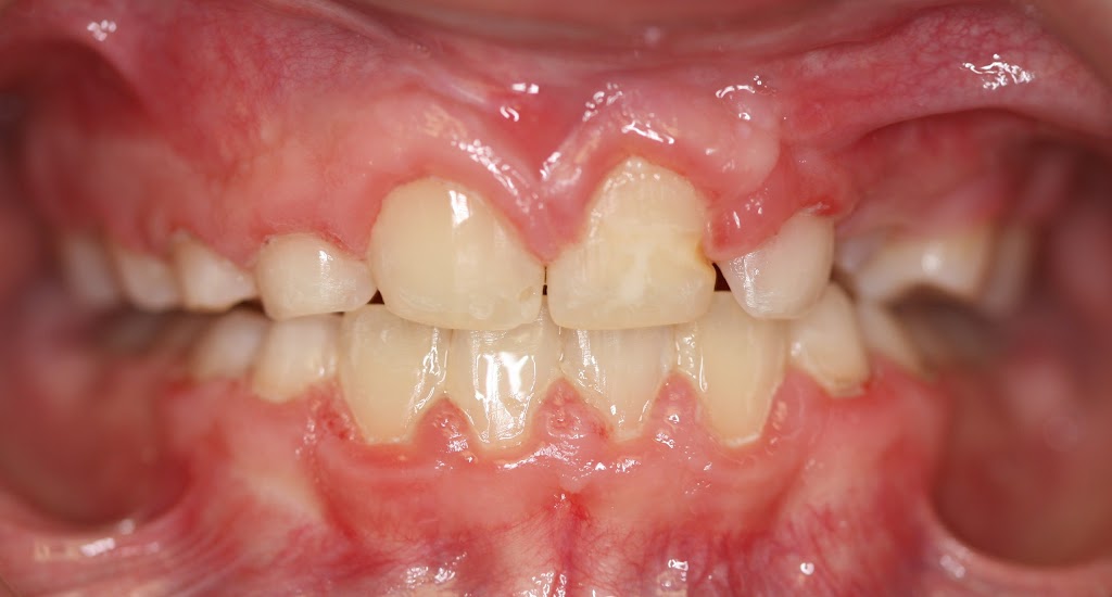 Bridgewater Orthodontist Dr. Matthew Choi | 1130 US-202, Raritan, NJ 08869 | Phone: (908) 722-3377
