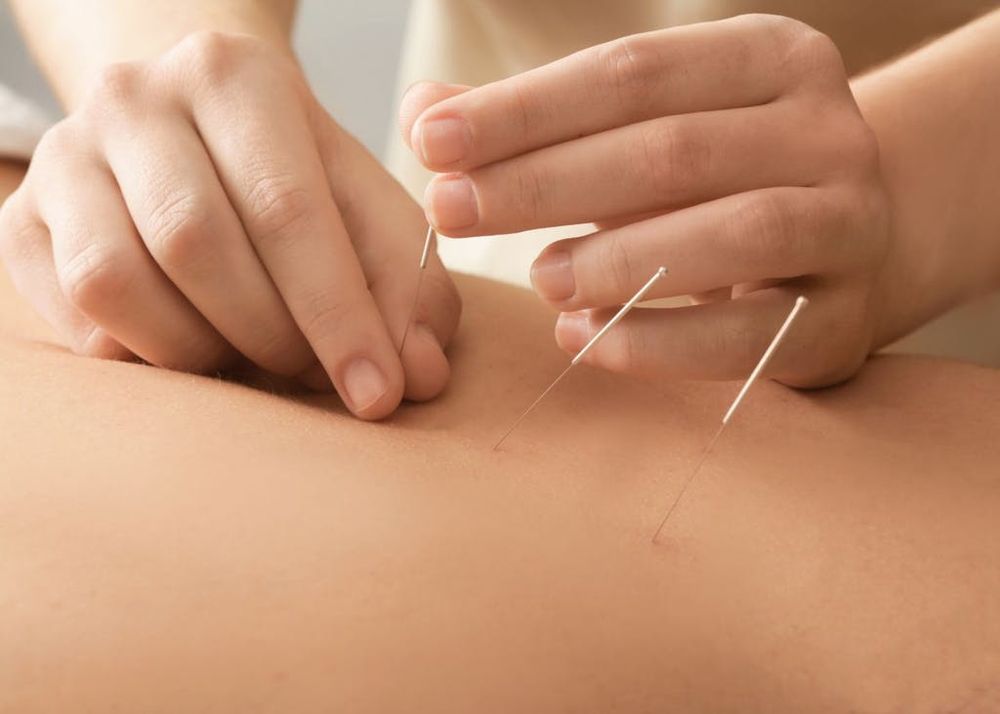 UNC Acupuncture Wellness Clinic | 120 Sylvan Ave #203, Englewood Cliffs, NJ 07632 | Phone: (201) 886-0077